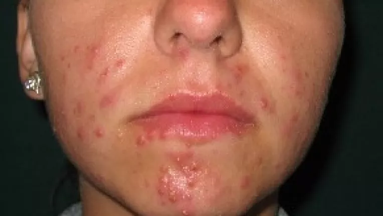 Fata, "fereastra sanatatii tale"